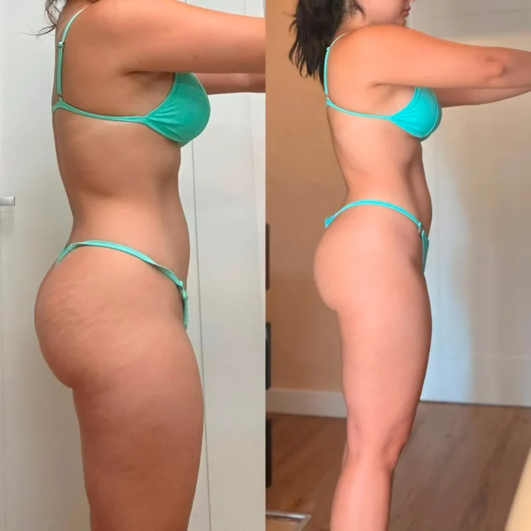 antes-despues-1