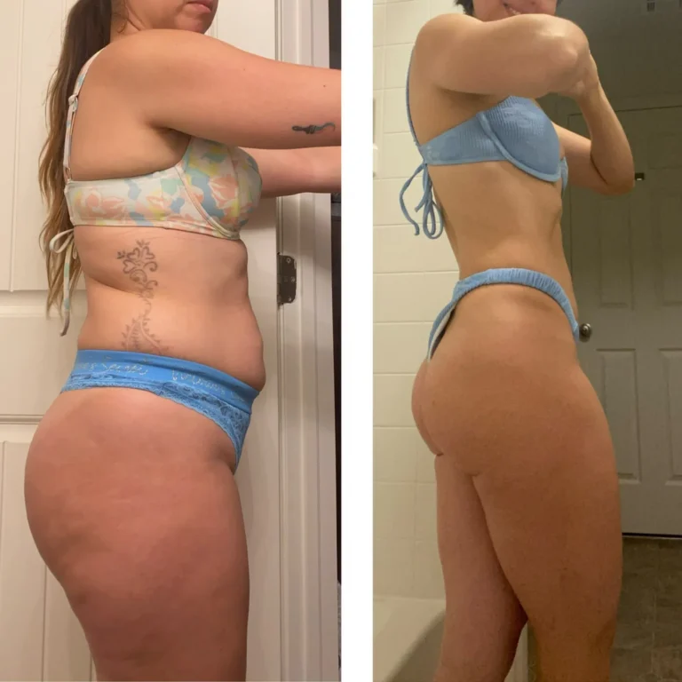 antes-despues-2