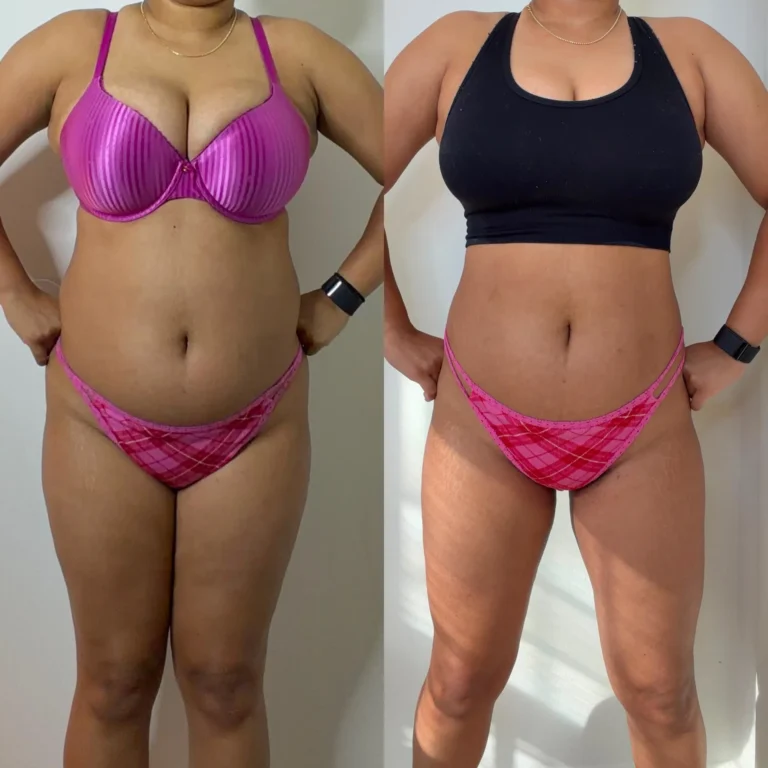 antes-despues-3