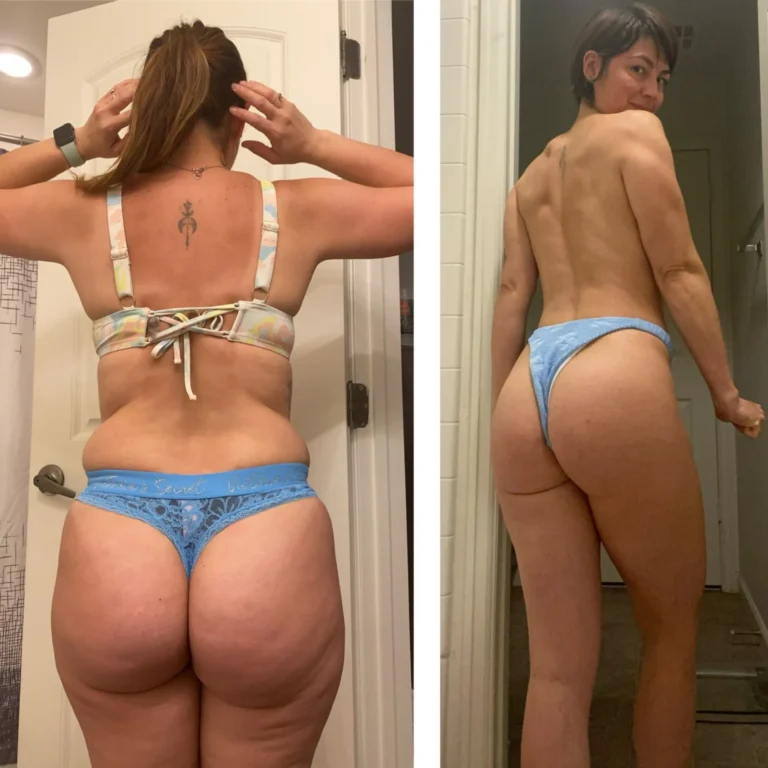 antes-despues-5